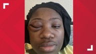 Woman sues APD, city of Austin over injuries at 6th Street shooting