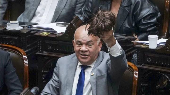 Quién es Aldo Leiva, el diputado con peluca que votó contra los vetos de Milei