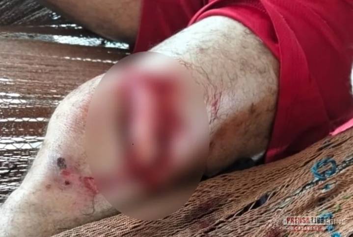 Campesino de Paz de Ariporo atacado por un animal silvestre requiere evacuación aérea desde distante vereda