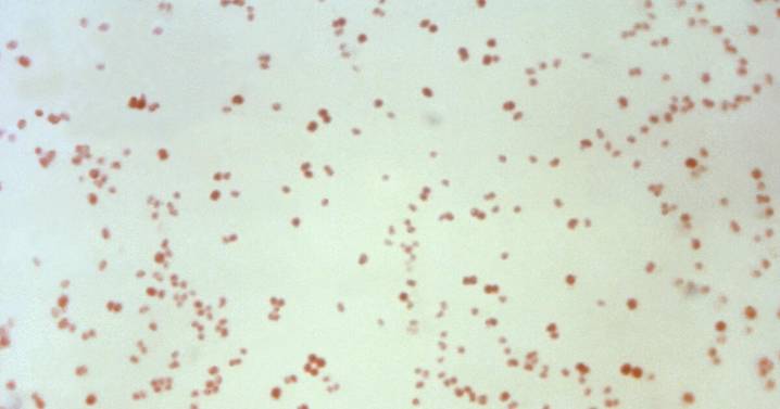 Sexually transmitted disease cases fall, but not syphilis in newborns