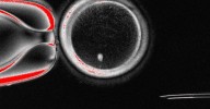 Desarrollan óvulos humanos potencialmente fecundables a partir de células de la piel