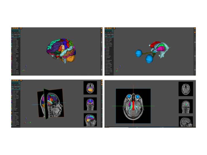 AnaVu: IIIT-Hyderabad’s 3D Anatomy Visualization Platform