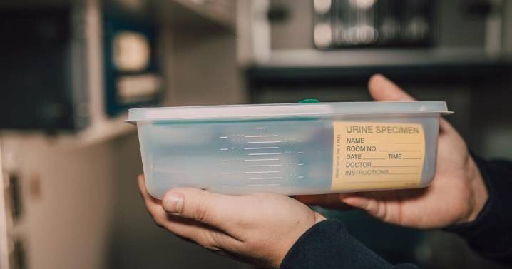 Study shows simple urine test could detect dementia warning signs