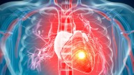 You can 'CATCH a deadly heart attack' as scientists discover they 'can be contagious'