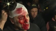 Gravísimo: Golpearon y le partieron la cara a un periodista de América TV en el acto de Milei