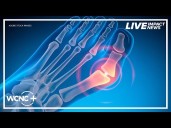 Breakthrough AI technology improves bunion surgery: How it works