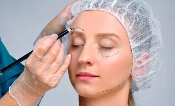 Cejaplastía: la cirugía tendencia para rejuvenecer el rostro