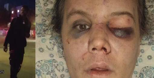 Four arrested after attack at Renton Transit Center