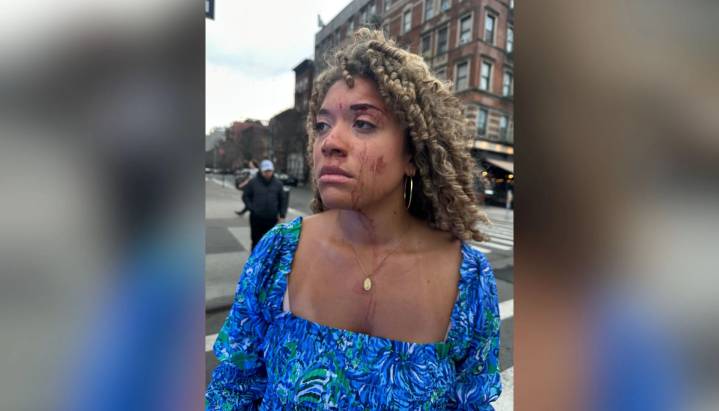 New York prosecutor drops charges against suspect in bloody assault on pro
