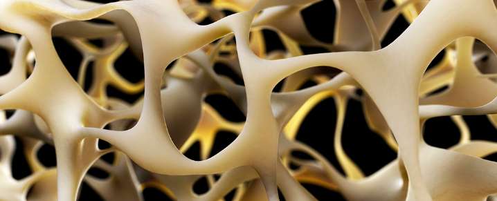 New Breakthrough to Strengthen Bones Could Reverse Osteoporosis