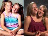 La inspiradora vida de Abby y Brittany Hensel, siamesas que comparte cuerpo ¿y ahora también un bebé?