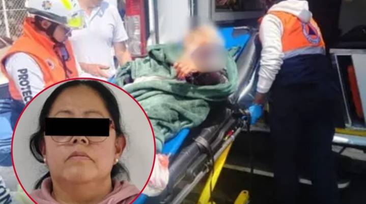 Le amputan brazo a una abuelita tras ataque de un perro Pitb...