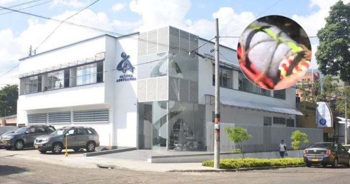 Detalles del accidente de los hinchas del Deportivo Pereira en Tolima: hay una persona en cuidados intensivos