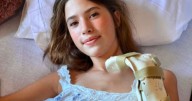 Teen who lost leg in double shark attack horror threw punches at beast while being savaged