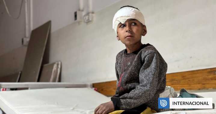 Al menos 21 mil niños de Gaza han quedado discapacitados desde el inicio de la guerra