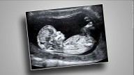 Texas has a new abortion pill law. But at least one provider plans to keep shipping them there