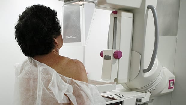 Major overhaul ordered for panel that sets Canada's cancer screening guidelines