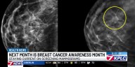 With Breast Cancer Awareness Month starting next week, health care professionals are advising women to stay up to date with their mammograms