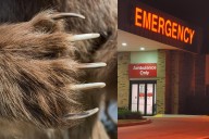 Hiker Survives Shocking Bear Attack in Yellowstone National Park