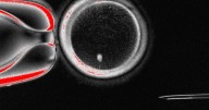 Scientists create human eggs in the lab, using skin cells