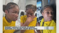 Mother speaks out on bullying after daughter suffers eye injury at middle school in Louisiana