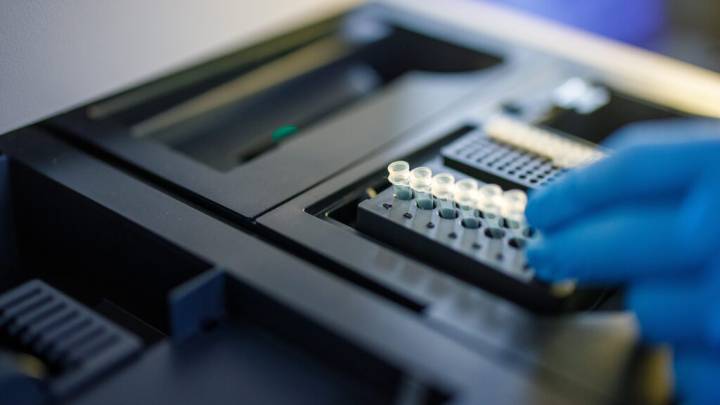 Exact Sciences launches Cancerguard, a liquid biopsy cancer test