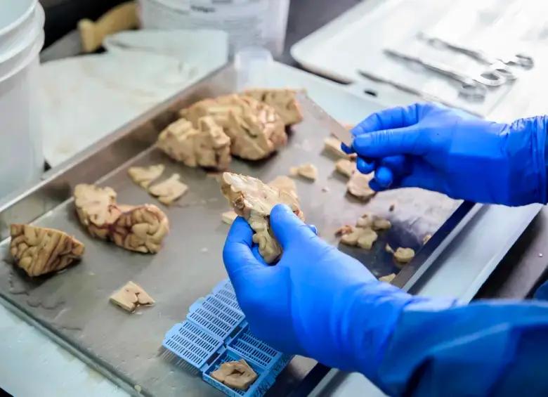 ¿Qué pasó con la investigación contra el Alzhéimer tras un año de la muerte de Francisco Lopera?