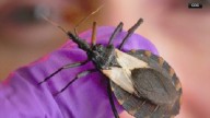 CDC warns of deadly bug disease that has been reported in Arkansas