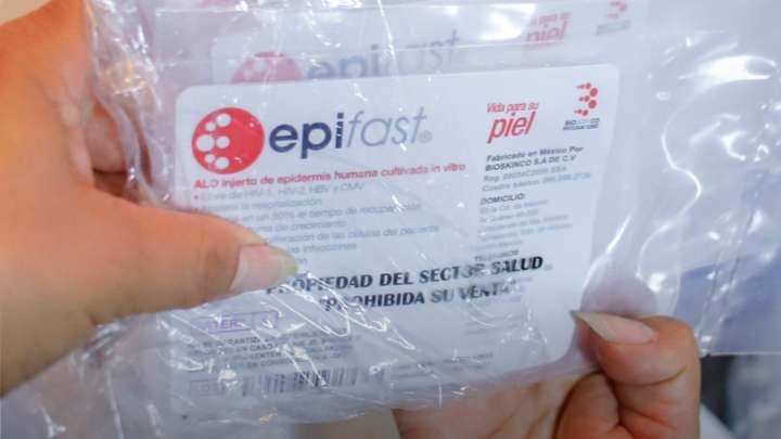 Explosión en Iztapalapa: Ayudan a Víctimas con Injerto de Piel Cultivada en Laboratorio