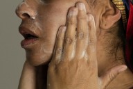 Dermatologists: Keep your skin care simple