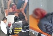 Accidente en bicicleta deja a adulto mayor herido en importante vía porteña