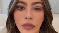 Sofia Vergara rushed to the ER after suffering ‘craziest’ allergy on the way to the Emmys and is forced to skip show