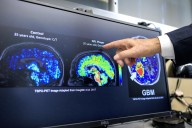 Científicos latinos en EEUU hallan biomarcador que podría detectar temprano el Alzheimer