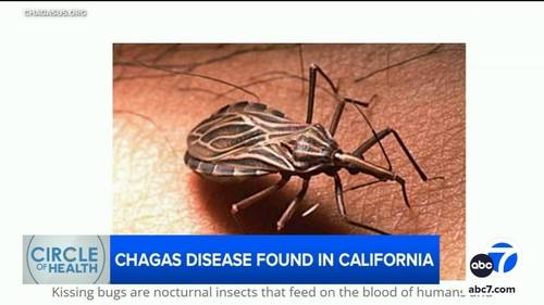 Chagas disease, parasitic infection from 'kissing bugs,' found in SoCal. What to know about the illness, including symptoms