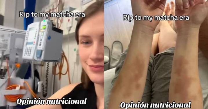 Joven revela cómo terminó en el hospital por anemia tras consumir demasiada matcha