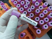 New Pill Offers Hope for Patients With Hard-to-Treat Lung Cancer Mutation