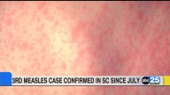 SC’s 3rd measles case confirmed as vaccines face polarizing views by U.S. health officials