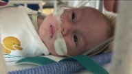Rare procedure saves Pflugerville baby's life in utero