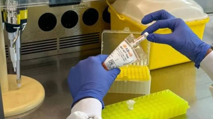 Nace el primer test en sangre que permite adelantarse al alzhéimer