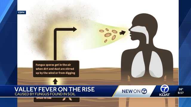 New Mexicans among the most at-risk populations for Valley fever