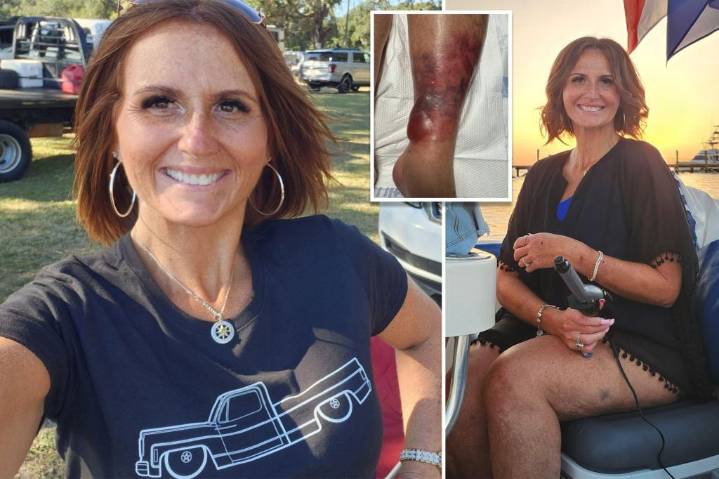 Mom Genevieve Gallagher nearly loses life and leg after contracting flesh
