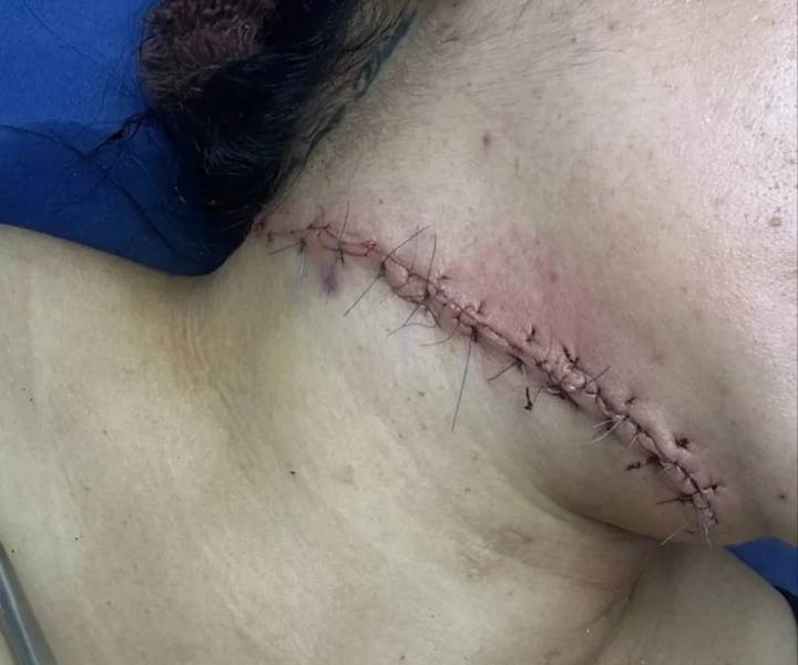 Hombre intentó degollar a venezolana en Perú (+Fotos)