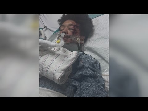 Family of metro Atlanta boy hurt in deadly Alabama ATV crash questions safety at park