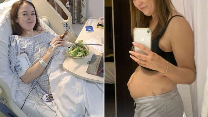 I was left looking five months' pregnant and couldn't have sex after doctors 'gaslit' me into thinking I had IBS