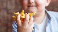 En el mundo hay más niños obesos que con bajo peso: "La desnutrición está conviviendo como epidemia con el sobrepeso"