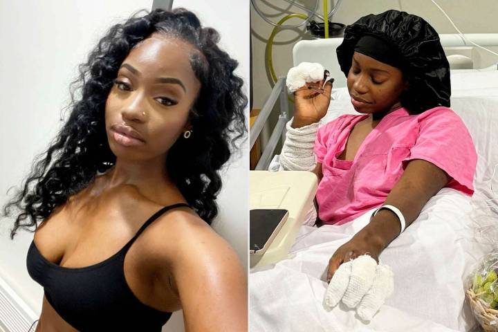 Teen Has Limbs Amputated After Mistaking Serious Infection for Flu in England