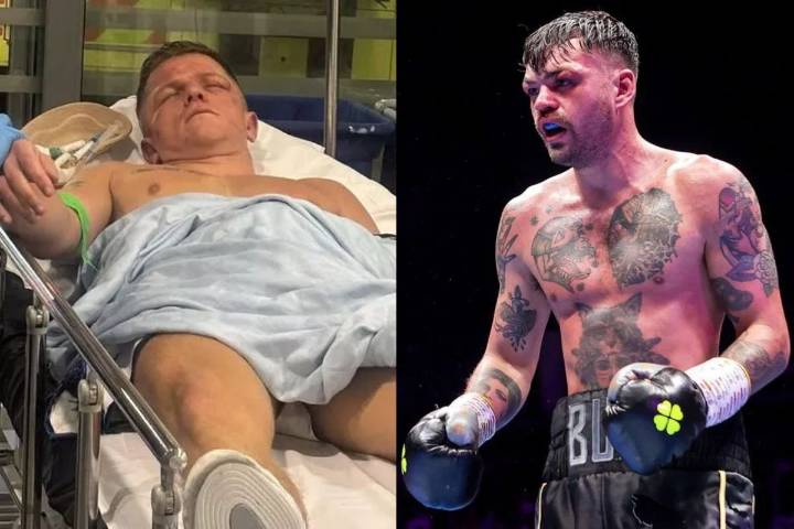 Irish Boxer Gets Heartfelt Note From Opponent as He Retires After Being Rushed to Hospital Boxer from Ireland, who sparred with Conor McGregor, announces retirement after being sent to the hospital af