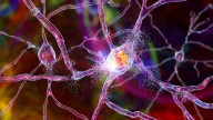Desarrollan el primer tratamiento exitoso para un mal neurodegenerativo, la enfermedad de Huntington