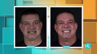 Stop hiding behind a bad smile with advanced dental implants