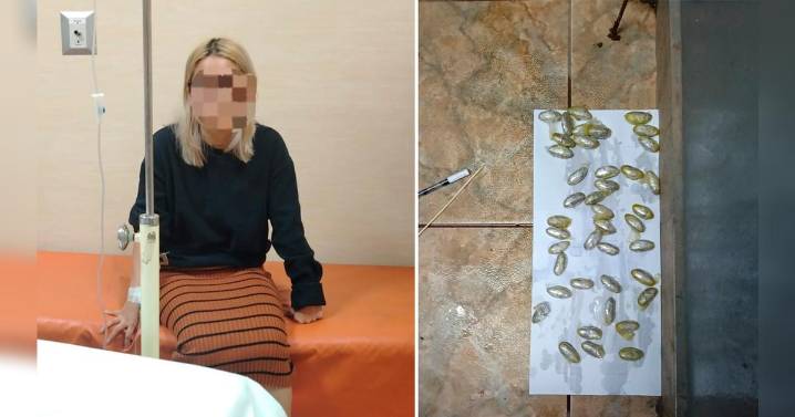 Arequipa: mujer intentó ingresar al penal con droga en el estómago